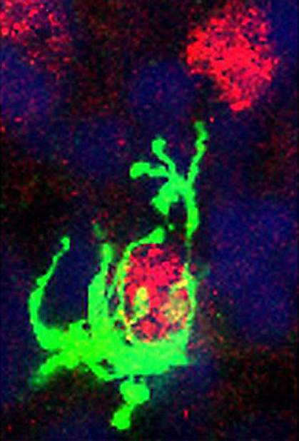 Confocal micrograph of a microglial cell engulfing a neural precursor cell.
