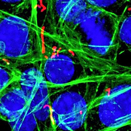 Strand-like bacteria inside cells.