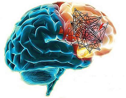 Schizophrenia networks in the human brain.