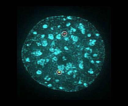 Chromosome translocation