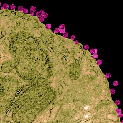 AIDS virus particles on a cell.