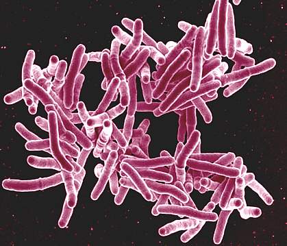 A group of strand-like bacteria.
