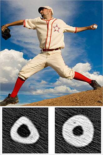 A baseball pitcher throwing, with cross-sections underneath of bigger bone under the throwing arm and smaller bone under the non-throwing arm.