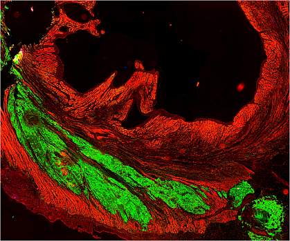Microscopic image of heart muscle, with large fluorescent green areas among red.