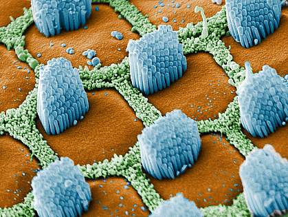 Auditory hair cells.