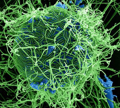 Strand-like Ebola Virons