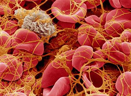 Cells in a blood clot.