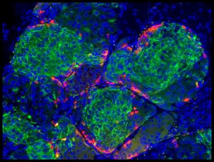 Human stem cell-derived beta cells.