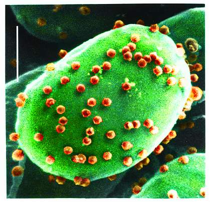 Alga infected with a chlorovirus.