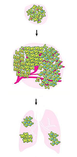Illustration of cells in a tumor.