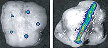 Scans of injection devices in tumors.