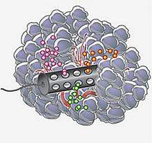 Illustration of cylindrical device inside a tumor.