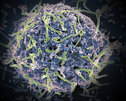 Ebola virus on a cell culture.