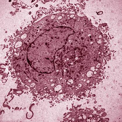 Mast cell.