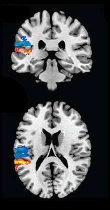 Brain Images