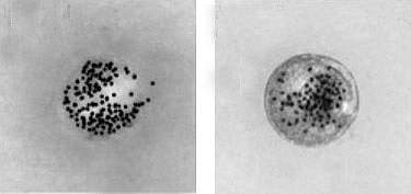 Transmission electron micrograph of an exosome