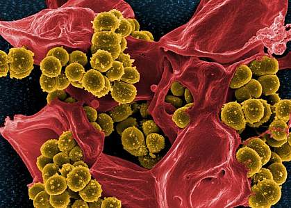 MRSA.