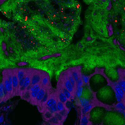 Mice fed emulsifiers had bacteria (red) deep in the mucus layer (green) so they were closer to intestinal cells (purple and blue) than they should be.