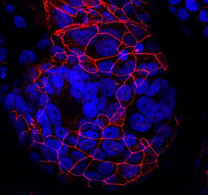 Fused trophoblasts