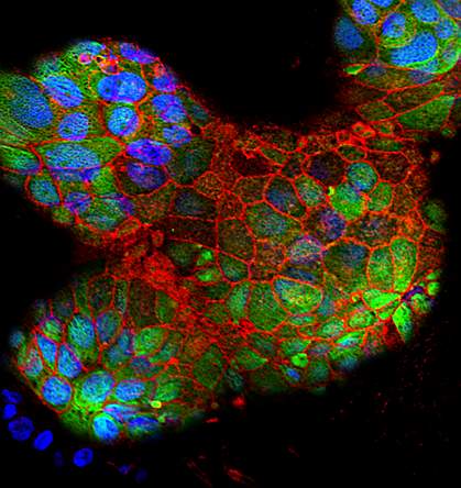 Placental cells grown in bioreactor