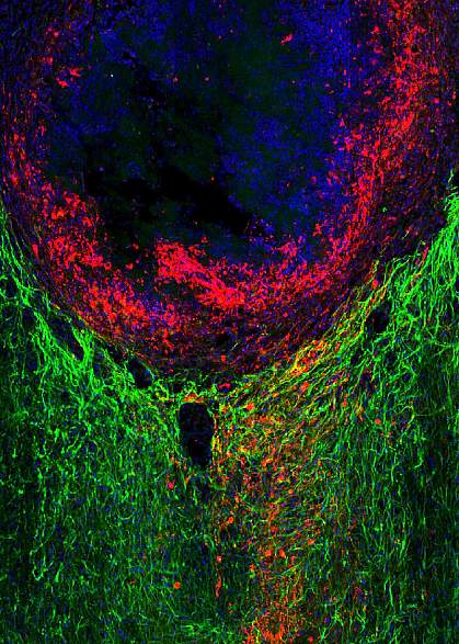 Axon regrowth through an astrocyte scar