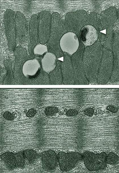 Electron microscope images of mouse muscle.