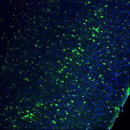 Neurons in adult mouse brain