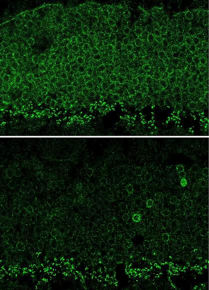 Nrl gene expression in mouse retina