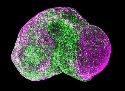 Fused forebrain spheroids