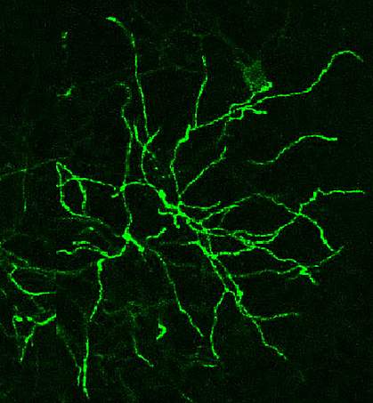 Confocal microscope image of neurons
