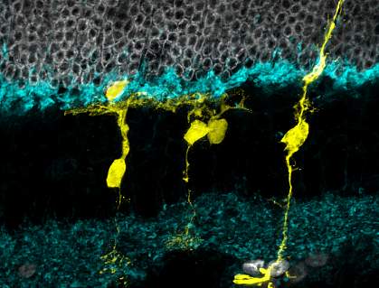 Image of a mouse retina under a fluorescent microscope
