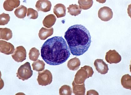 Micrograph of Giemsa-stained monocytes
