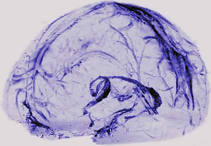 Lymphatic vessels in human brain