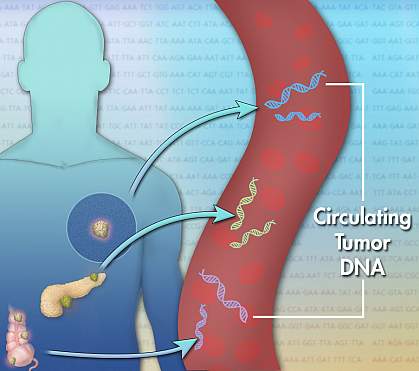 Illustration with arrows showing DNA moving from tumors into the bloodstream
