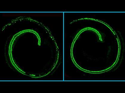 Confocal microscopy images of mouse cochlea.