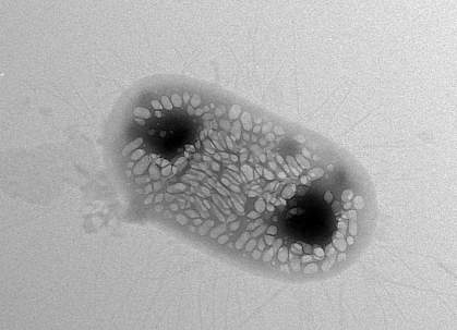 Transmission electron micrograph image of a genetically engineered E. coli bacterium.