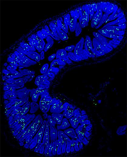 Microscopic image of IL-17 in the small intestine of a mouse 