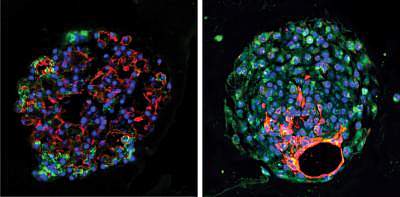 Lung organoids