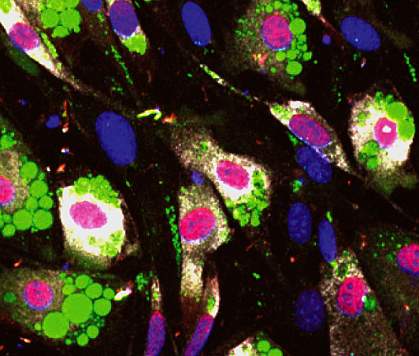 Microscope image of fat precursor cells.