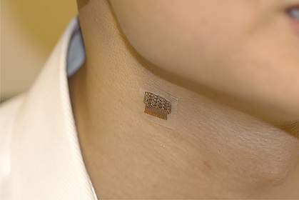 Wearable ultrasound patch on neck.