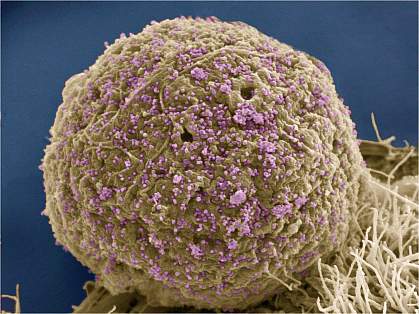 HIV-infected cell