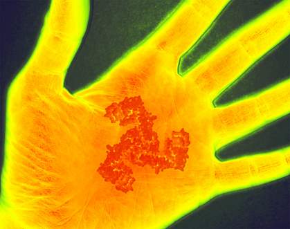 Image of a scan of a hand undergoing inflammation