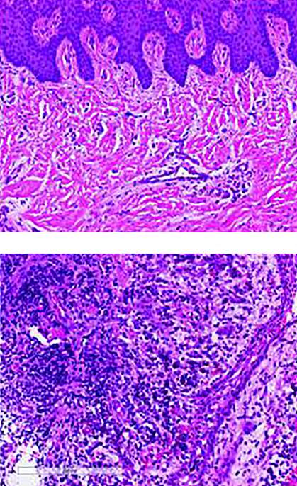 Histological images of gum tissue