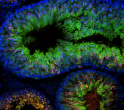 Sperm in mouse testes