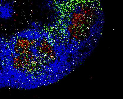 Immune cells in tonsil