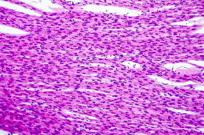 Histological image of heart muscle
