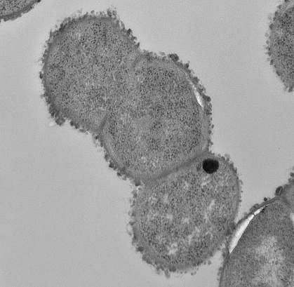 Electron micrograph of Ruminococcus gnavus