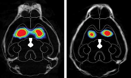 Brains of mice injected with misfolded alpha-synuclein have less dopamine