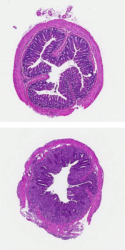 Sections of mouse colon tissue