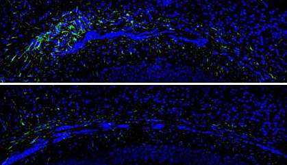 Astrocytes in mouse corpus callosum